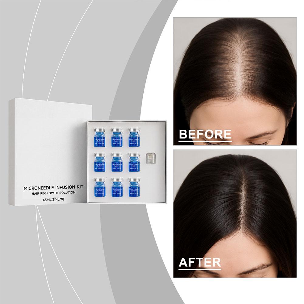 Hair Care Conditioner - Kit de Rolo de Microagulhas com