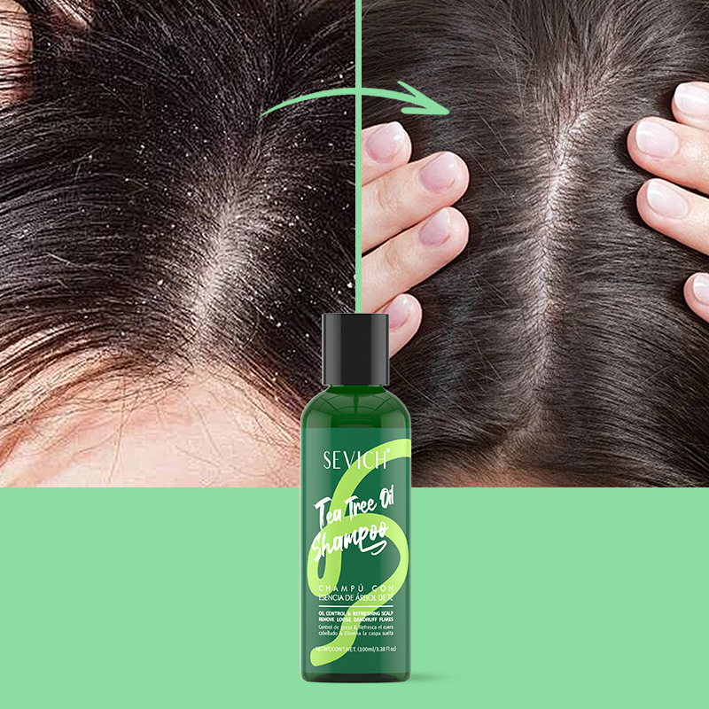 Chá árvore essência shampoo co - Hair Care Conditioner avaliação e preço